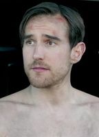 Jacob Anderton